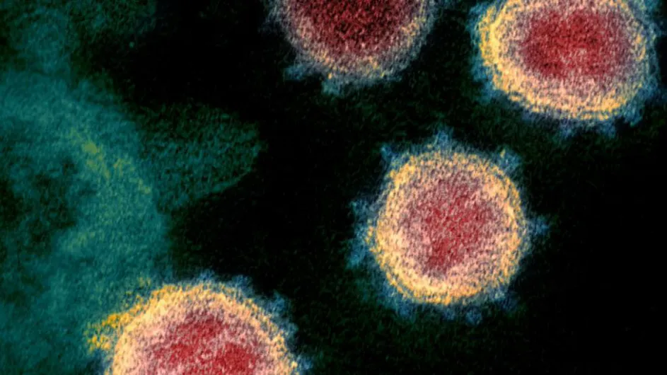 SARS-CoV-2 virus