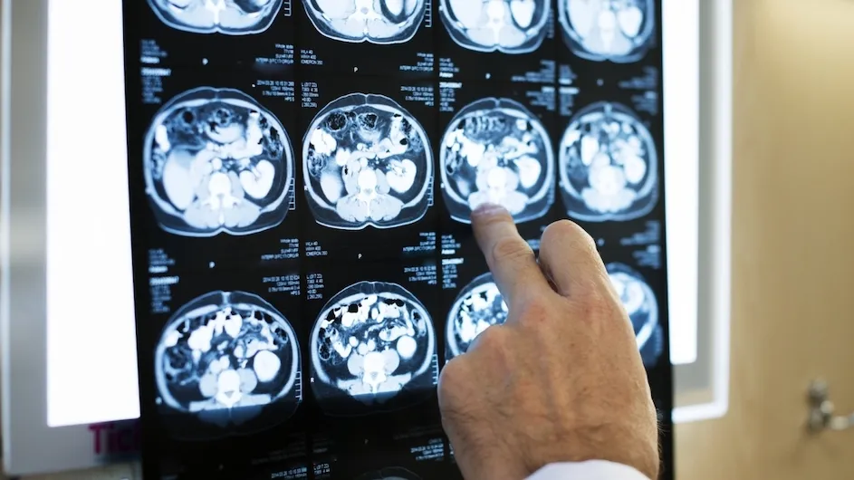 A doctor points at images of patient brain scans.