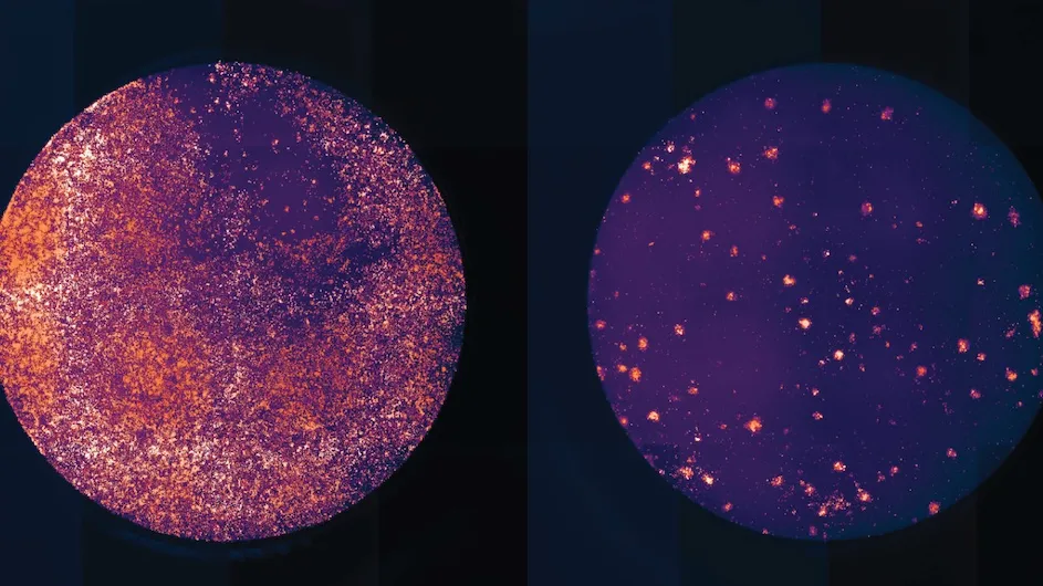 Engineered mutant T cells (right) showing far fewer tumor survivors than un-edited T cells (left).