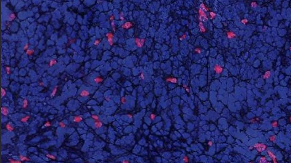 TFF2-MSA,  anti-PD-1 antibody, or their combination were studied in multiple syngeneic mouse models of gastric cancer.