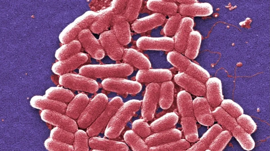 Scanning electron microscopic (SEM) image depicting a growing cluster of E. coli bacteria from by Janice Haney Carr / CDC