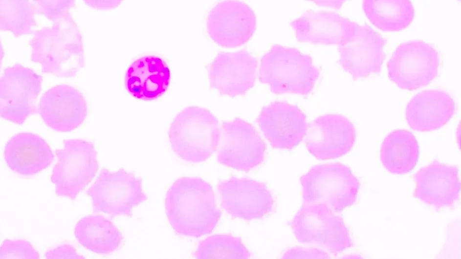 Malarial cells.