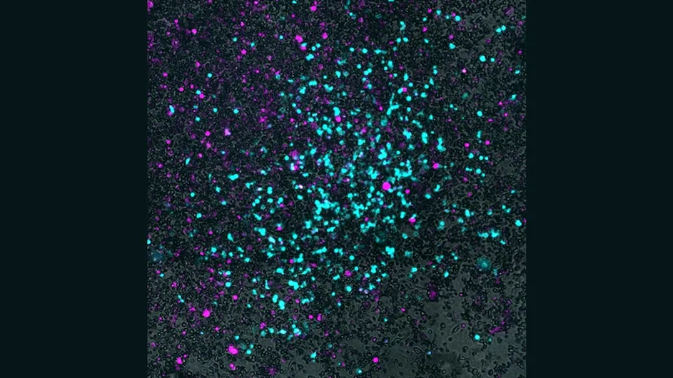 In this microscopic image, grey indicates small cell lung cancer cells, magenta shows Salmonella that have entered the cancer cells, and cyan reveals the virus spreading outward in a circular pattern from the center of the culture.