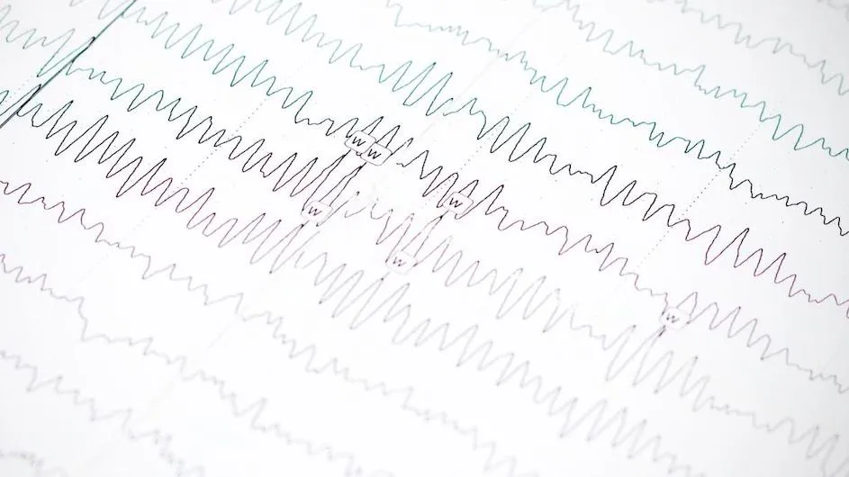 Bursts of activity—called sleep spindles—in EEG recordings