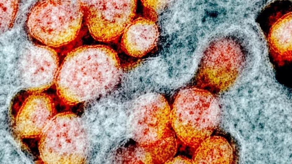 The SARS-CoV-2 virus under a microscope.