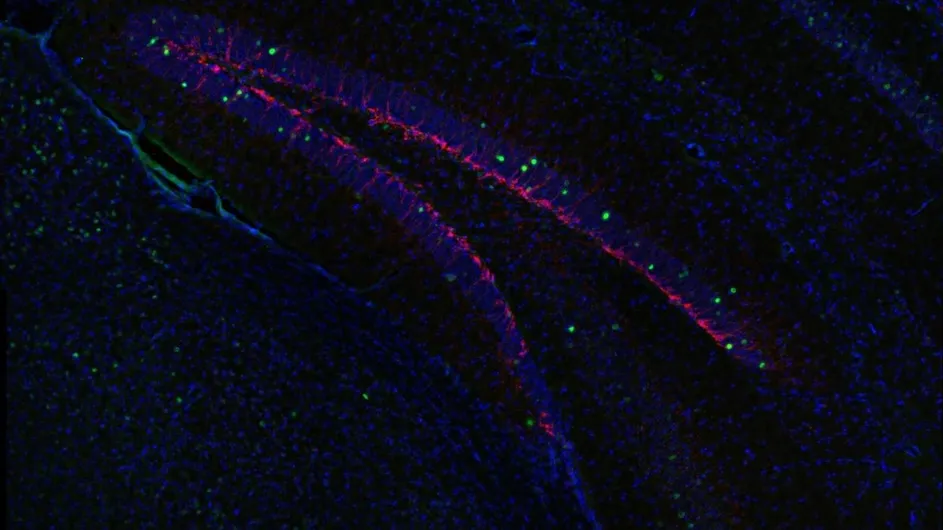 In stressed animals, inhibition of SGK1 may prevent depressive and suicidal behaviors by increasing the number of new neurons (pink) created in the brain's hippocampus. 