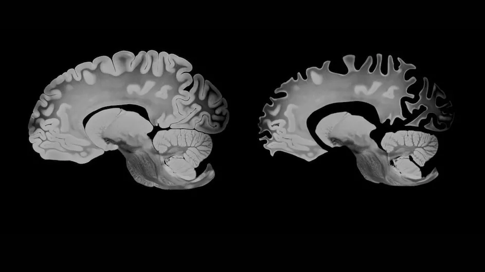 Images of brain scans