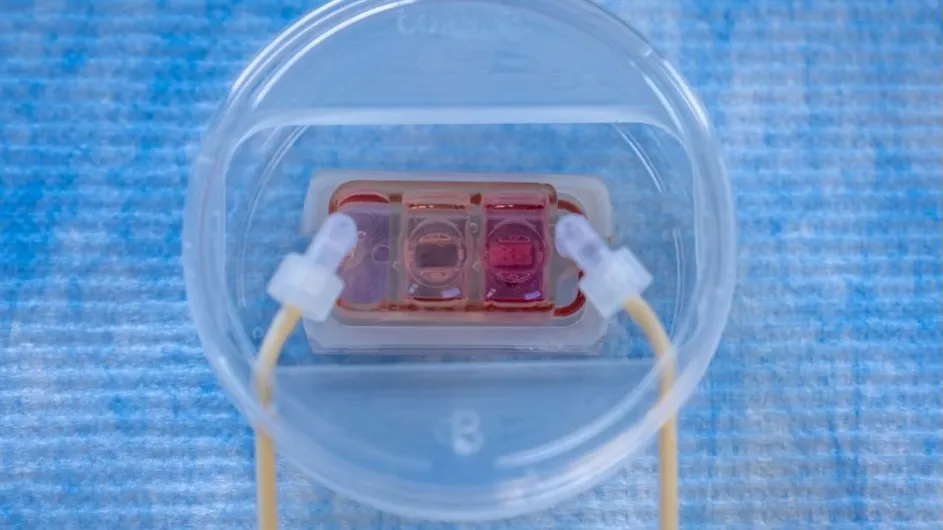 The Organs-on chip platform
