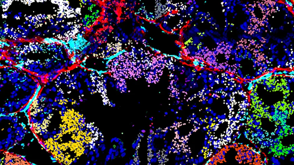 Mapping Multimodal Phenotypes to Perturbations in Cells and Tissue with CRISPRmap. Visualization of in vivo CRISPRmap barcode detection on a xenograft tumor section, showing the guide distribution in the tumor microenvironment. Decoded CRISPR guide-identifying barcodes detected by CRISPRmap are shown as spots false-colored according to their guide identity. Image credit: Gaublomme Lab.