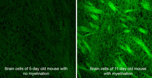 Using deuterium-labeled SRS imaging, researchers watched the brain cells of developing mice rapidly put on fat in a process called myelination. The ability to detect normal and abnormal myelination could help in detecting head injuries and monitoring the progression of multiple sclerosis. (Min lab/Columbia)
