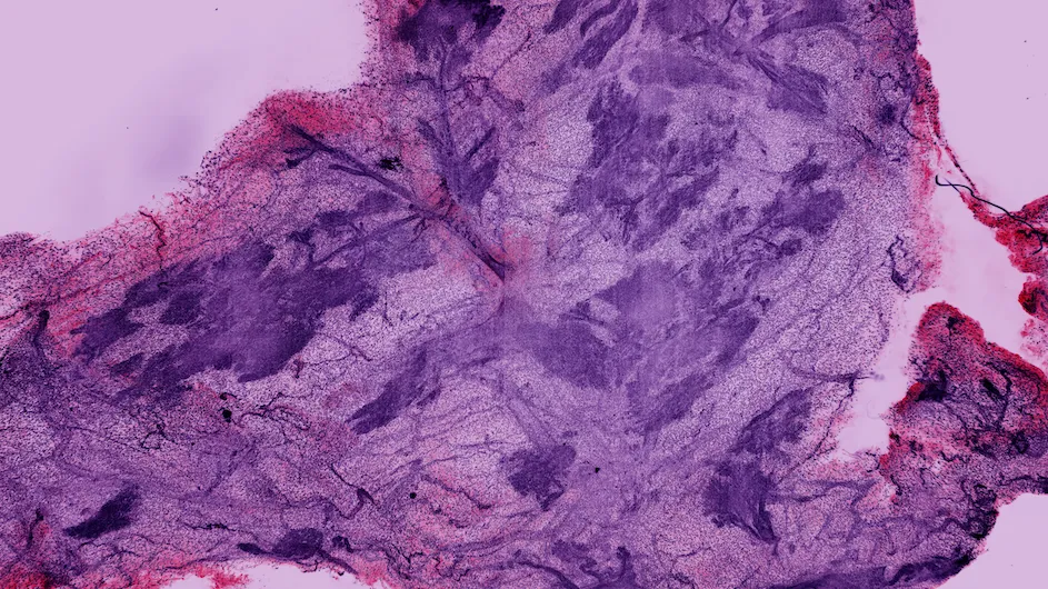 Human breast tissue imaged with SCOPE, a new device developed by Professor Raju Tomer and colleagues. The detailed 3D view of the milk-producing glands (called lobules) that are visible here is inaccessible with traditional microscopes.