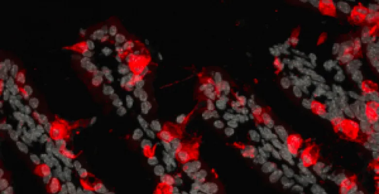 Inactivation of Foxo1, a gene important for metabolism generated insulin producing cells in small intestines of newborn mice, as detected by immunofluorescence in red.Drs. Talchai and Accili found that when they turned off a gene known to play a role in cell fate decisions—Foxo1—the progenitor cells also generated insulin-producing cells. More cells were generated when Foxo1 was turned off early in development, but insulin-producing cells were also generated when the gene was turned off after the mice had r
