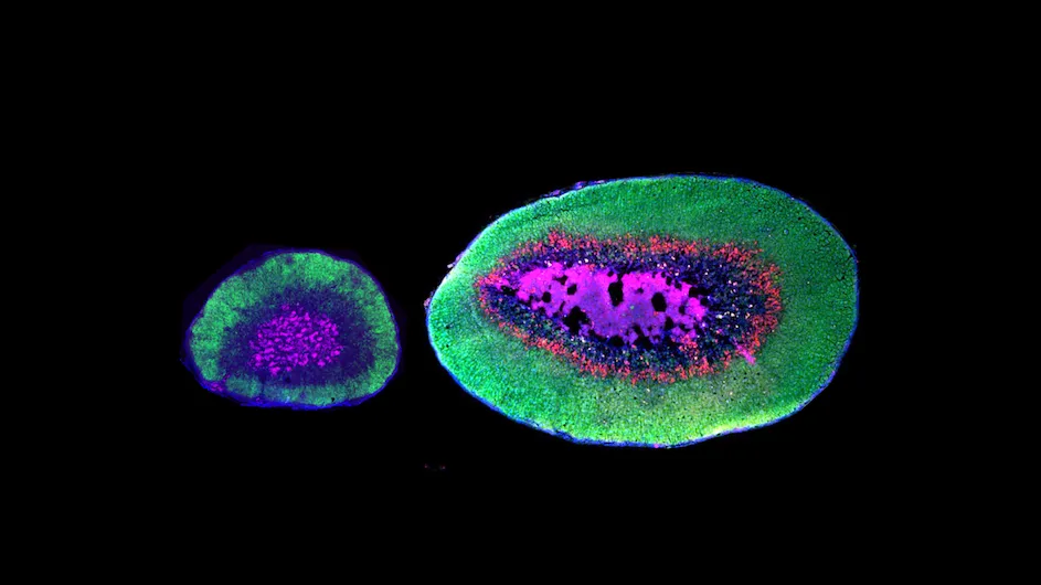The adrenal glands of a deer mouse (left) and oldfield mouse (right), showing the relative size of the zona fasciculata (green) and the novel zona inaudita (red).