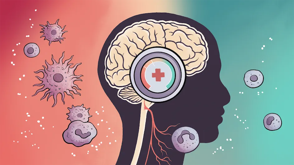 Illustration of a human brain with a thermostat-like device that symbolizes the brain's ability to amp up or tamp down inflammation responses.