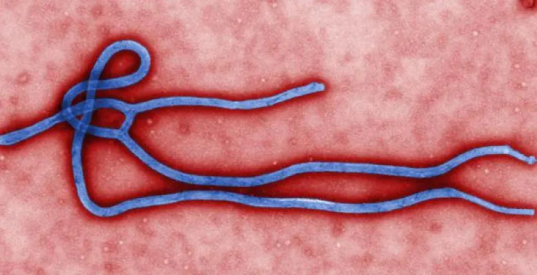 Colorized transmission electron micrograph of the Ebola virus virion. Credit: CDC/ Cynthia Goldsmith.