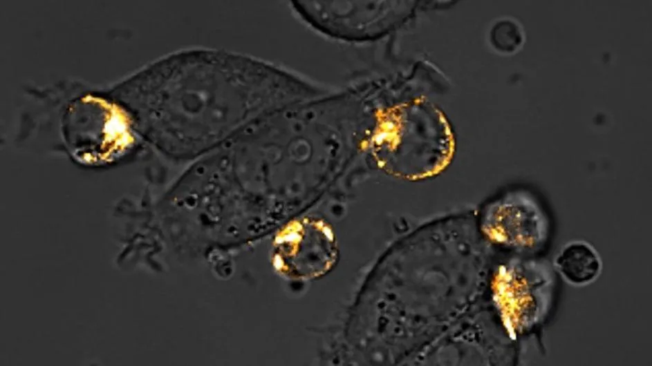 Microscopy image of CAR-T cells attacking ‘painted’ breast cancer cells. (Credit: Rosa Vincent and Thomas Savage/Columbia Engineering)
