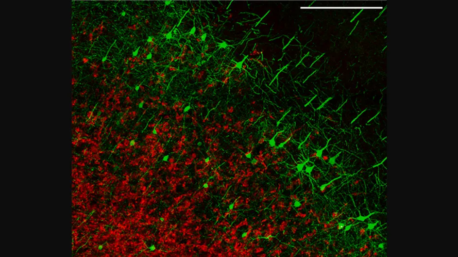 A representative field of the tumor-infiltrated cortex (glioma cells: mCherry; red) of a Thy1-EGFP-M mouse (neurons; green), scale bar: 250 mm (Photo credit: Canoll Lab).