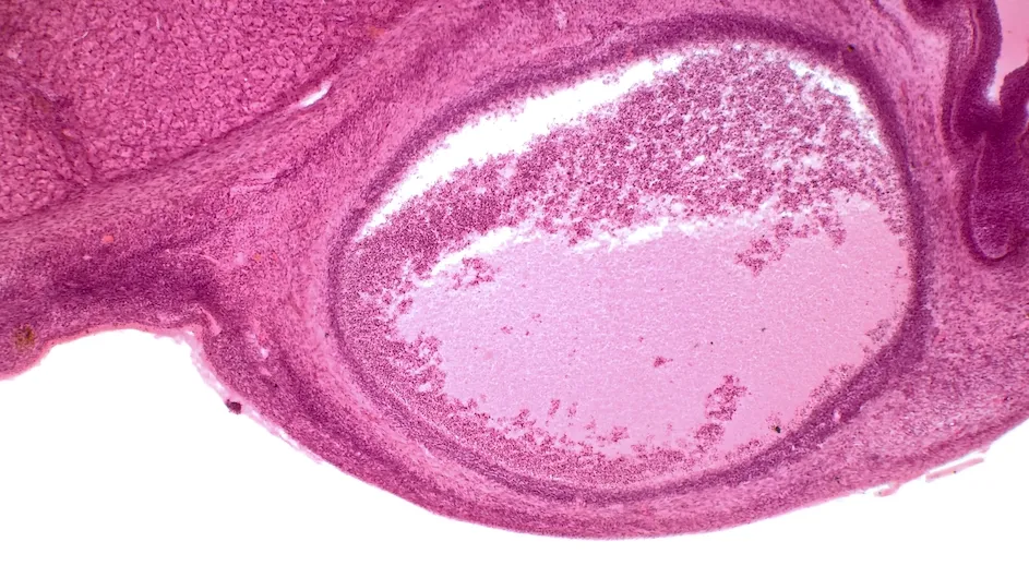 A human ovary.