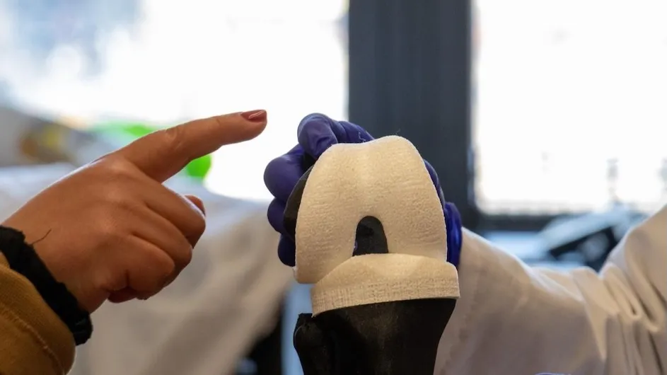 A new “living knee” implant designed by Columbia researchers, called NOVAKnee.