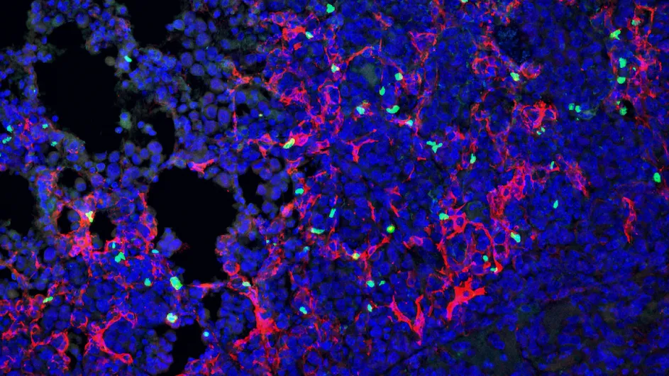 Uncovering how the newly identified fibroblast cells in the lung protect cancer was a tough task. The breakthrough came after graduate student Olivia Ringham spent hours examining images of the cells around lung tumors. “I remember being in the microscope room with my slides of all my different cancer models, looking around, and then I just saw this striking pattern of regulatory T cells sitting amidst the fibroblasts, and I was like, 'that's interesting,'" Ringham recalls.