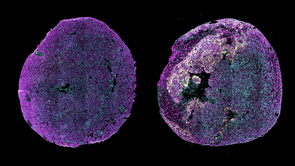 Immunofluorescence image of transverse heart sections from a healthy neonatal mouse (Left) or a neonatal mouse in which myocardial infarction was induced at postnatal day 1, examined 3 days after injury (Right).