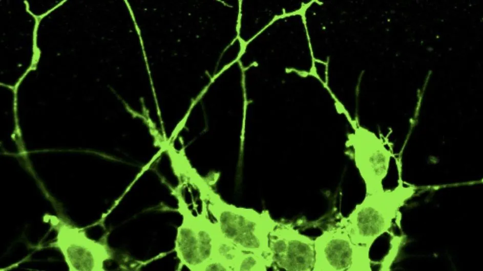 As lung cancer cells evolve, Yang has found that some start extending long structures that look like the axons of neurons and start to migrate. Image provided by Dian Yang/Columbia University Vagelos College of Physicians and Surgeons.