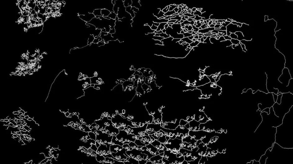 An image of the multiple tracings of the skin's sensory neurons that were characterized in this study.